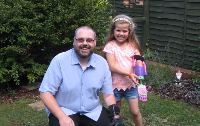 8-летняя девочка-инвалид получила дизайнерский 3D-протез (7 фото)